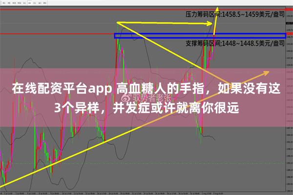 在线配资平台app 高血糖人的手指，如果没有这3个异样，并发症或许就离你很远